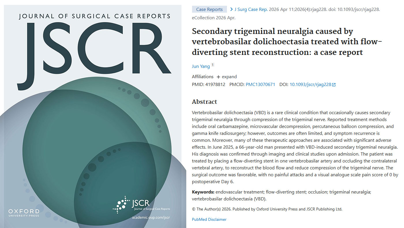 Secondary trigeminal neuralgia caused by vertebrobasilar dolichoectasia treated with flow-diverting stent reconstruction: a case report. Journal of Surgical Case Reports